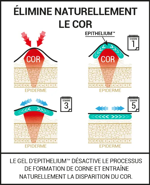 Protections pour les cors et oeils-de-perdrix