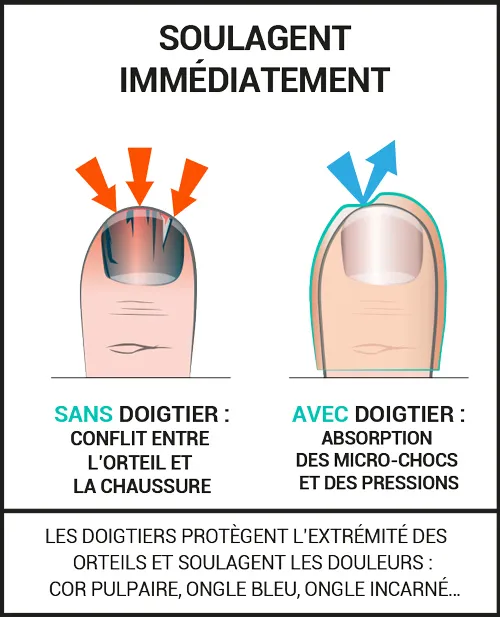 Protections pour les cors pulpaires et ongles incarnés