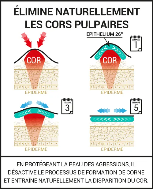 Protections pour les cors pulpaires et ongles incarnés