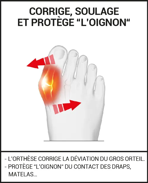 Orthèse Hallux Valgus Nuit