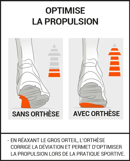 Orthèse Hallux Valgus SPORT