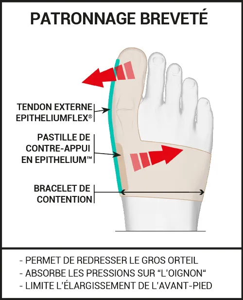 orthèse hallux valgus : redresseur d'orteil