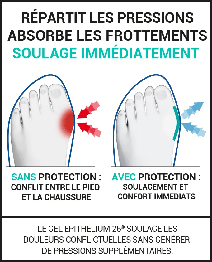 Protection quotidienne pour l’Hallux Valgus 