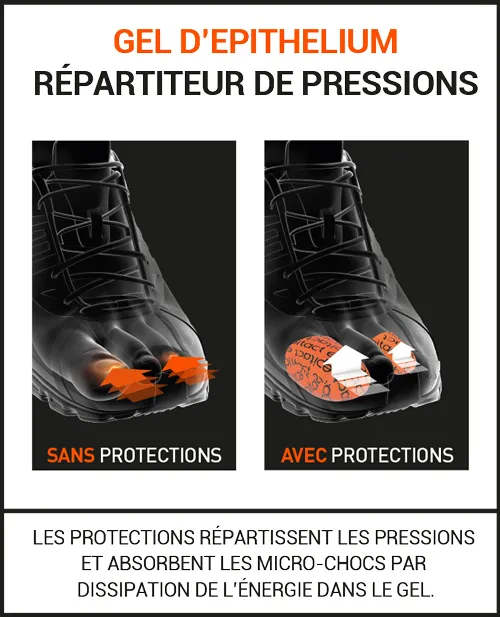 Protections ongles bleus durant la pratique du sport 