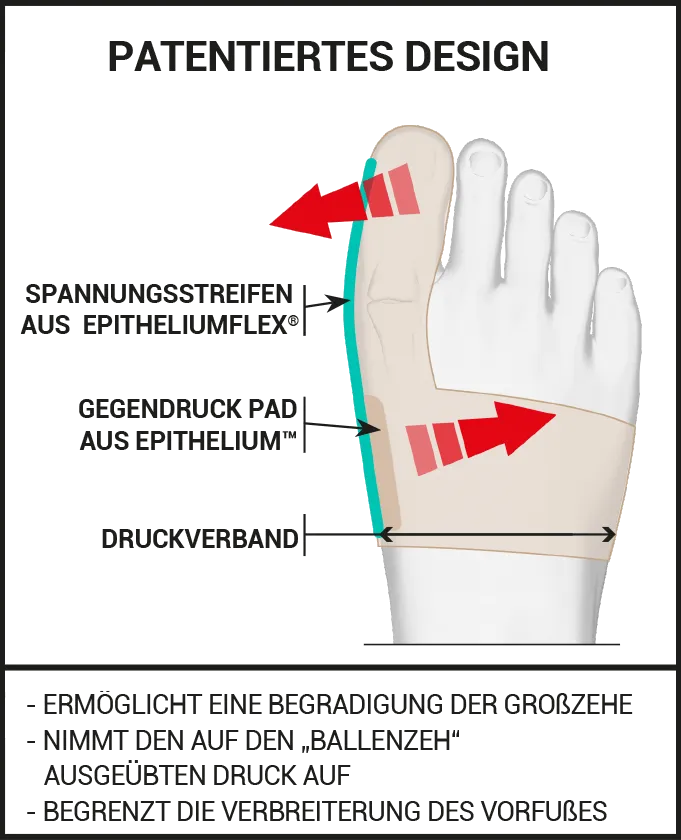 HALLUX-VALGUS-KORREKTURORTHESE 