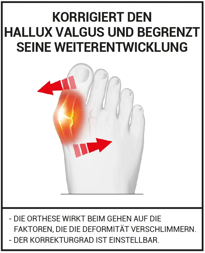 Flexible Hallux Valgus Korrekturbandage für den Tag