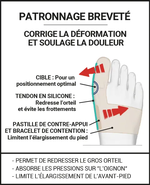 orthèse hallux valgus : redresseur d'orteil