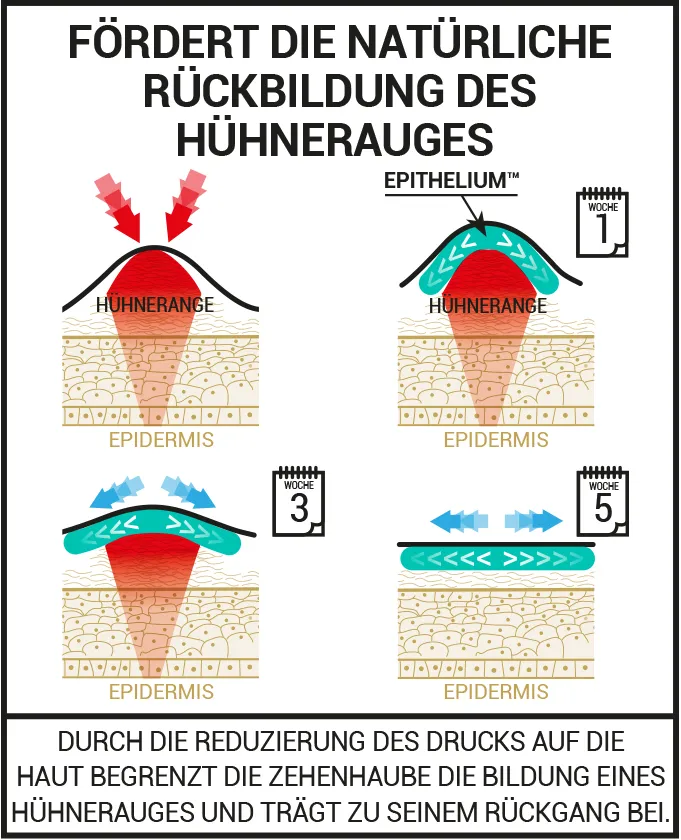 ZEHENSCHUTZKAPPE